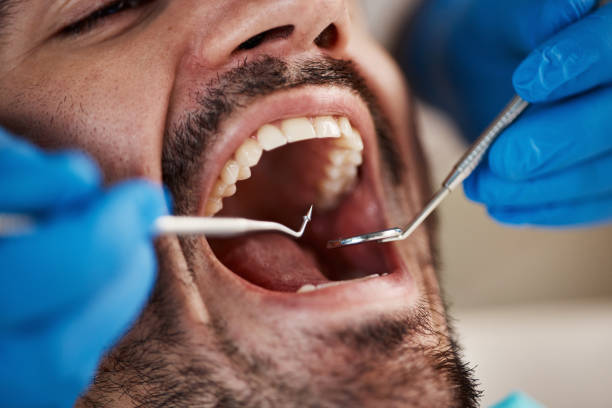 Best Emergency Cosmetic Dentistry (e.g., broken veneers) in Westchester, IL